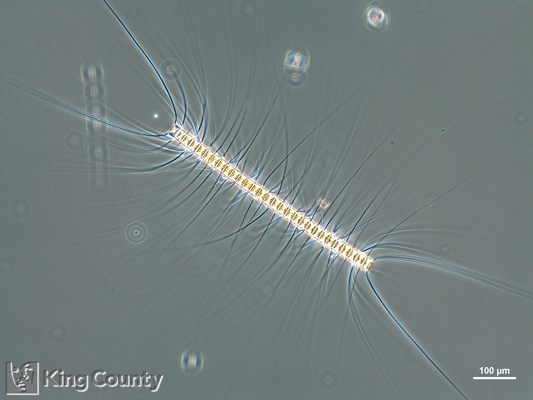 Photo of Chaetoceros vanheurckii